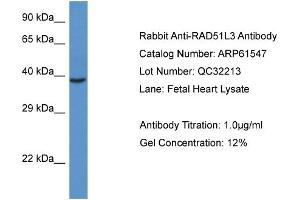 Western Blotting (WB) image for anti-RAD51 Homolog D (RAD51D) (C-Term) antibody (ABIN2788836) (RAD51D 抗体  (C-Term))