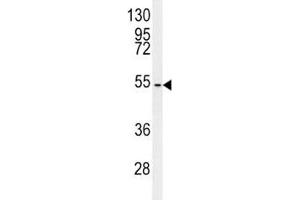 Western Blotting (WB) image for anti-CCZ1 Vacuolar Protein Trafficking and Biogenesis Associated Homolog (S. Cerevisiae) (CCZ1) (AA 239-265) antibody (ABIN3028541)