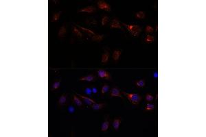 Immunofluorescence analysis of U-2 OS cells using PFDN4 antibody (ABIN7269508) at dilution of 1:100. (PFDN4 抗体  (AA 1-134))