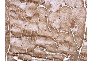 IHC-P Image RSK2 antibody detects RSK2 protein at cytosol and nucleus on mouse muscle by immunohistochemical analysis. (RPS6KA3 抗体  (Center))