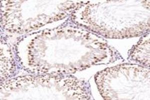 Immunohistochemistry analysis of paraffin-embedded mouse testis using,NUP133 (ABIN7074909) at dilution of 1: 4800 (NUP133 抗体)