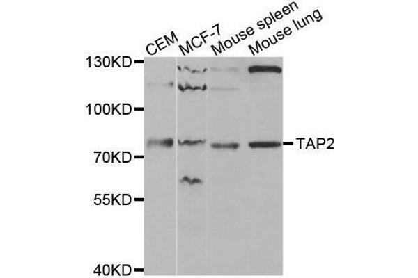 TAP2 抗体  (AA 430-680)