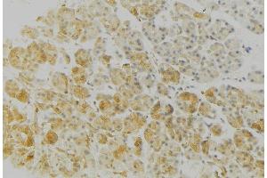 Immunohistochemistry (IHC) image for anti-Major Histocompatibility Complex, Class II, DR beta 3 (HLA-DRB3) antibody (ABIN6262292)