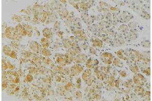 ABIN6276762 at 1/100 staining Human gastric tissue by IHC-P. (HLA-DRB3 抗体)