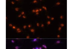 Immunofluorescence analysis of U-251MG cells using PRPF8 Polyclonal Antibody at dilution of 1:100 (20x lens). (PRPF8 抗体)
