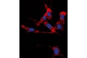 Immunofluorescent analysis of EPHB1/2 staining in HuvEc cells. (EPHB1/2 抗体)