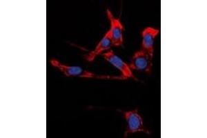 Immunofluorescent analysis of EPHB1/2 staining in HuvEc cells. (EPHB1/2 抗体)