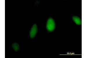 Immunofluorescence of purified MaxPab antibody to FANCL on HeLa cell. (FANCL 抗体  (AA 1-375))
