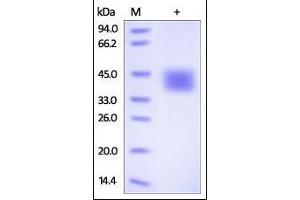 SDS-PAGE (SDS) image for CD84 (CD84) (AA 22-225) protein (His tag) (ABIN2180849)
