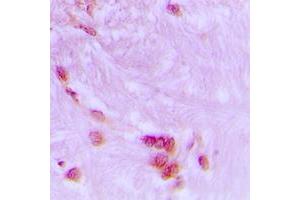 Immunohistochemical analysis of CDC27 staining in human brain formalin fixed paraffin embedded tissue section. (CDC27 抗体  (Center))
