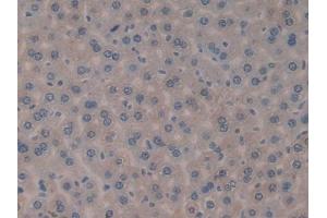 Immunohistochemistry (IHC) image for anti-Interleukin 1 delta (FIL1d) (AA 1-156) antibody (ABIN7442798)