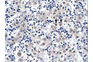 Image no. 2 for anti-Caudal Type Homeobox 4 (CDX4) (C-Term) antibody (ABIN6736267) (CDX4 抗体  (C-Term))
