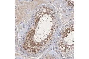 Immunohistochemical staining of human testis with C11orf58 polyclonal antibody  shows moderate cytoplasmic positivity in cells in seminiferus ducts at 1:20-1:50 dilution. (C11ORF58 抗体)