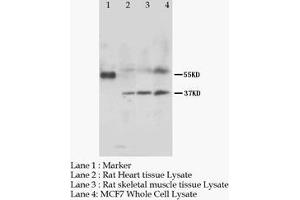 MRGPRC SNSR Polyclonal Antibody (MRGPRC 抗体  (N-Term))