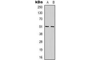 Western blot analysis of WIPF1 expression in Jurkat (A), K562 (B) whole cell lysates. (WIPF1 抗体  (C-Term))