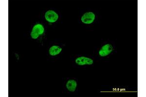 Immunofluorescence of monoclonal antibody to HNRPM on HepG2 cell. (HNRNPM 抗体  (AA 17-112))