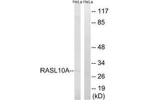 Western blot analysis of extracts from HeLa cells, using RASL10A Antibody.