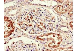 Immunohistochemistry of paraffin-embedded human kidney tissue using ABIN7170330 at dilution of 1:100 (SORD 抗体  (AA 201-357))