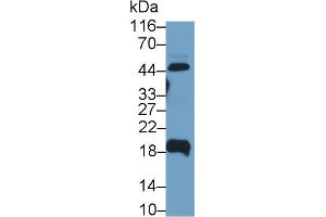 Detection of UPK2 in Human Urine using Polyclonal Antibody to Uroplakin 2 (UPK2) (Uroplakin 2 抗体  (AA 26-153))