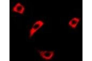 Immunofluorescent analysis of RASSF1 staining in Hela cells. (RASSF1 抗体)