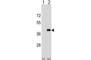 Western Blotting (WB) image for anti-Protein Phosphatase 1, Catalytic Subunit, gamma Isoform (PPP1CC) antibody (ABIN2999122) (PPP1CC 抗体)