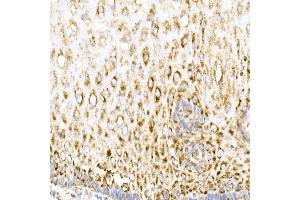 Immunohistochemistry of paraffin-embedded human esophagus using MDH2 Rabbit mAb (ABIN7268381) at dilution of 1:25 (40x lens). (MDH2 抗体)