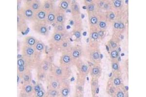 IHC-P analysis of Rat Tissue, with DAB staining. (Periostin 抗体  (AA 24-173))