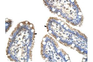 FZD9 antibody was used for immunohistochemistry at a concentration of 4-8 ug/ml to stain Epithelial cells of intestinal villus (arrows) in Human Intestine. (FZD9 抗体)