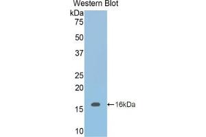 Western blot analysis of the recombinant protein. (INHBB 抗体  (AA 297-411))