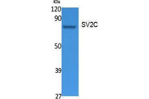 Western Blotting (WB) image for anti-Synaptic Vesicle Glycoprotein 2C (SV2C) (Internal Region) antibody (ABIN3187638) (SV2C 抗体  (Internal Region))