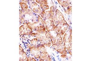 Immunohistochemical analysis of paraffin-embedded H. (MATN2 抗体  (AA 732-760))