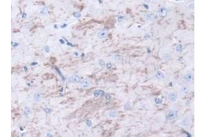 DAB staining on IHC-P; Samples: Mouse Cerebrum Tissue (METRN 抗体  (AA 22-291))