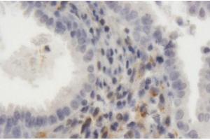 Immunoperoxidase of purified MaxPab antibody to LRP1 on formalin-fixed paraffin-embedded human endometrium. (LRP1 抗体  (AA 1-292))