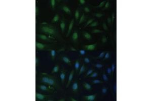 Immunofluorescence analysis of U-2 OS cells using p27 KIP 1 antibody (ABIN3020889, ABIN3020890, ABIN3020891 and ABIN6213779) at dilution of 1:100. (CDKN1B 抗体  (AA 1-198))