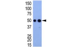 Western Blotting (WB) image for anti-HA-Tag antibody (ABIN2932102) (HA-Tag 抗体)