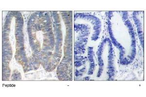Image no. 1 for anti-Eukaryotic Translation Initiation Factor 2-alpha Kinase 2 (EIF2AK2) (Thr451) antibody (ABIN197554) (EIF2AK2 抗体  (Thr451))