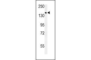 SD9 Antibody (C-term) (ABIN651896 and ABIN2840442) western blot analysis in MCF-7 cell line lysates (15 μg/lane). (SAMD9 抗体  (C-Term))