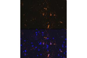 Immunofluorescence (IF) image for anti-Glial Fibrillary Acidic Protein (GFAP) antibody (ABIN7267389)