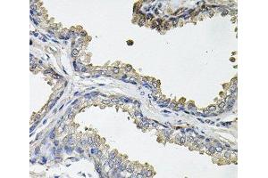Immunohistochemistry of paraffin-embedded Human prostate using ACO1 Polyclonal Antibody at dilution of 1:100 (40x lens). (Aconitase 1 抗体)