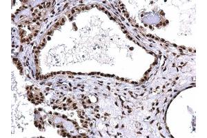 Immunohistochemistry (IHC) image for anti-Small Nuclear Ribonucleoprotein D2 Polypeptide 16.5kDa (SNRPD2) antibody (ABIN2855196)