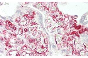 Detection of CD32 in Human Placenta Tissue using Polyclonal Antibody to Cluster Of Differentiation 32 (CD32) (Fc gamma RII (CD32) (AA 69-309) 抗体)