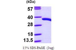 Pyridoxal (Pyridoxine, Vitamin B6) Phosphatase (PDXP) (AA 1-296) protein (His tag)