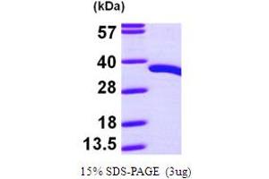 SDS-PAGE (SDS) image for Pyridoxal (Pyridoxine, Vitamin B6) Phosphatase (PDXP) (AA 1-296) protein (His tag) (ABIN667804)