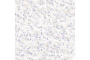 Immunohistochemistry of paraffin-embedded Human liver using TROP-2 antibody (ABIN7271103) at dilution of 1:2700 (40x lens).