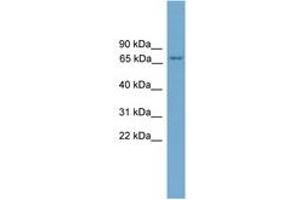 Image no. 1 for anti-Protein Kinase C, eta (PRKCH) (AA 35-84) antibody (ABIN6746461) (PKC eta 抗体  (AA 35-84))