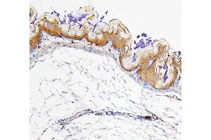 IHC analysis of ALDH1A1 using anti-ALDH1A1 antibody (ABIN7602127).