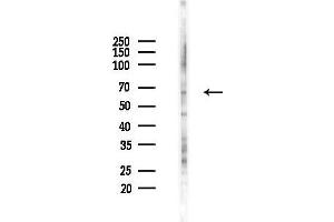 Western blot analysis of lysates from K562 cells(UV 30 min treatment), using Phospho-RACGAP1 (Ser387) Antibody at 1/1000 dilution.