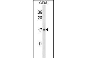 IL21 Antibody (C-term) (ABIN657761 and ABIN2846740) western blot analysis in CEM cell line lysates (35 μg/lane). (IL-21 抗体  (C-Term))