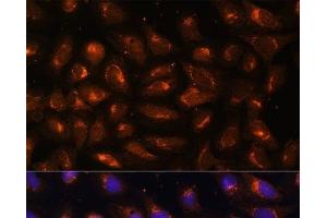 Immunofluorescence analysis of U-2 OS cells using CKMT1B Polyclonal Antibody at dilution of 1:100 (40x lens). (CKMT1B 抗体)