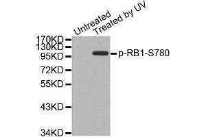 Western blot analysis of extracts from 3T3 cells, using Phospho-RB1-S780 antibody. (Retinoblastoma 1 抗体  (pSer780))